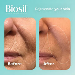 Biosil Collagen Generator – 120 Capsules | Patented ch-OSA® Complex | 60-Day Supply